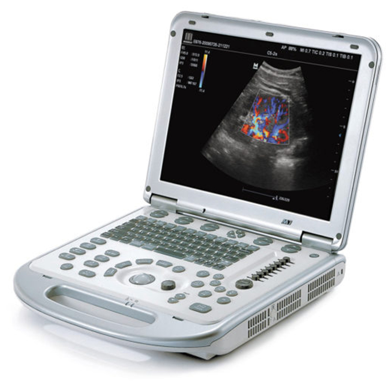 Mindray DP-50 Ultrasound Diagnostic System